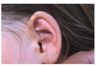 Picture of a Human Ear