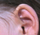 Picture of an ear.