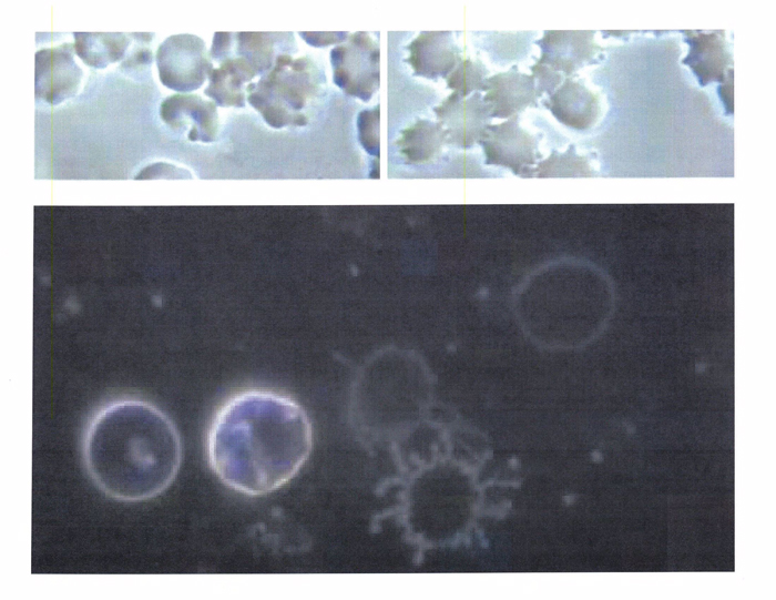 Removing Graphene Oxide: Page 7